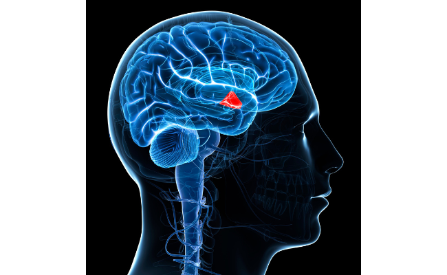 How to Treat Chiari Malformation?