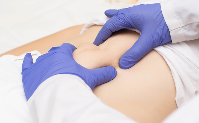 How to Treat Hiatus Hernia?