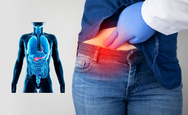 How to Treat Pancreatitis Acute?