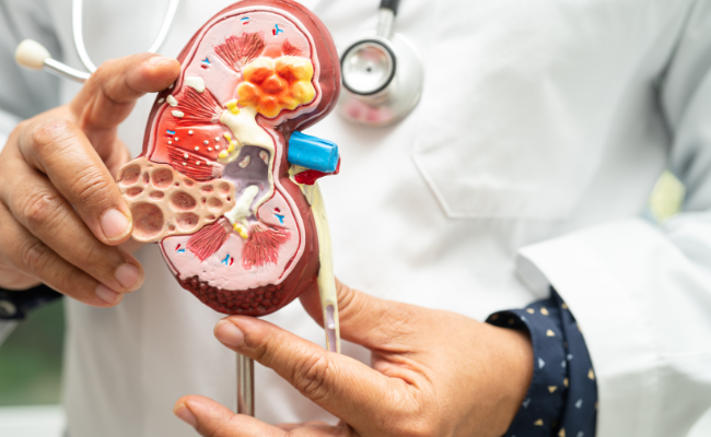 How to Treat Chronic Kidney Disease?