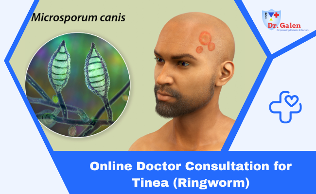 Online Doctor Consultation for Tinea (Ringworm)