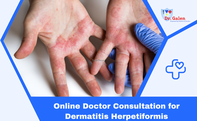 Online Doctor Consultation for Dermatitis herpetiformis