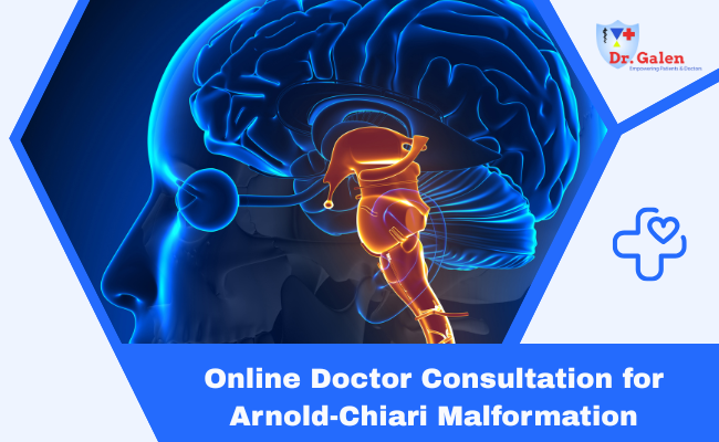 Online Doctor Consultation for Arnold-Chiari Malformation