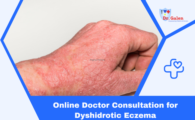 Online Doctor Consultation for Dyshidrotic Eczema