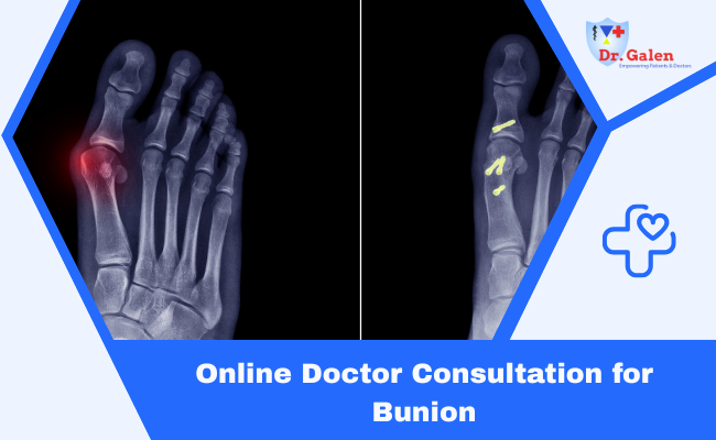 Online Doctor Consultation for Bunion