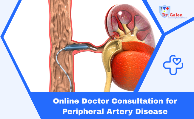 Online Doctor Consultation for Peripheral Artery Disease