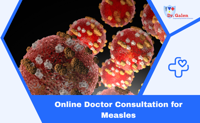 Online Doctor consultation for Measles