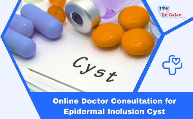 Online Doctor Consultation for Epidermal Inclusion Cyst