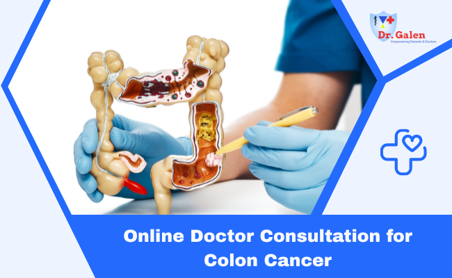 Online Doctor Consultation for Colon Cancer