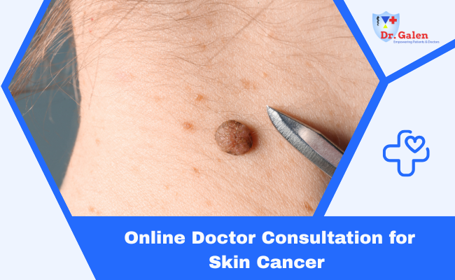 Online Doctor Consultation for Skin Cancer