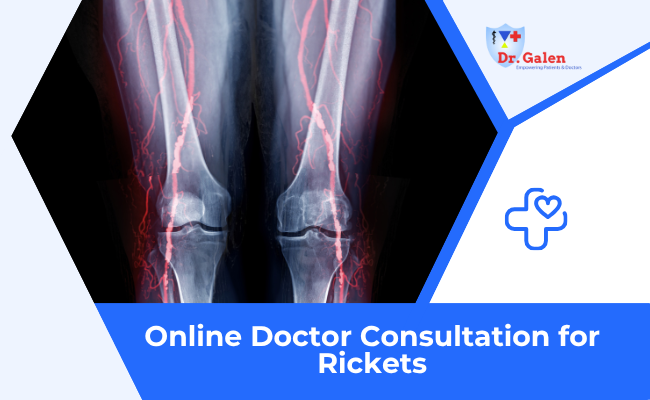 Online Doctor consultation for Rickets