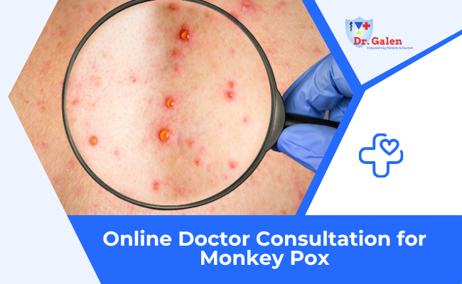 Online Doctor Consultation for Mpox (monkeypox) Virus